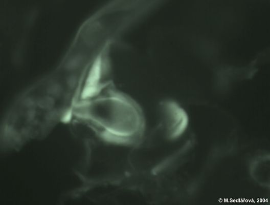 Bremia lactucae - Plse saltov
(oomycota)
haustorium umouje parazitu erpn ivin z pletiv hostitele
Foto: M.Sedlov